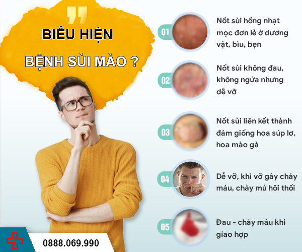 Nhận biết các biểu hiện bệnh sùi mào gà ngay từ sớm!