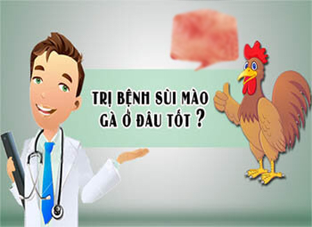 Chữa sùi mào gà ở đâu uy tín tại Hà Nội