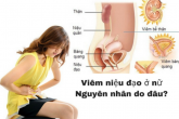 Viêm niệu đạo nữ: nguyên nhân, triệu chứng và cách chữa!