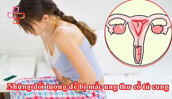 Những đối tượng dễ bị mắc ung thư cổ tử cung