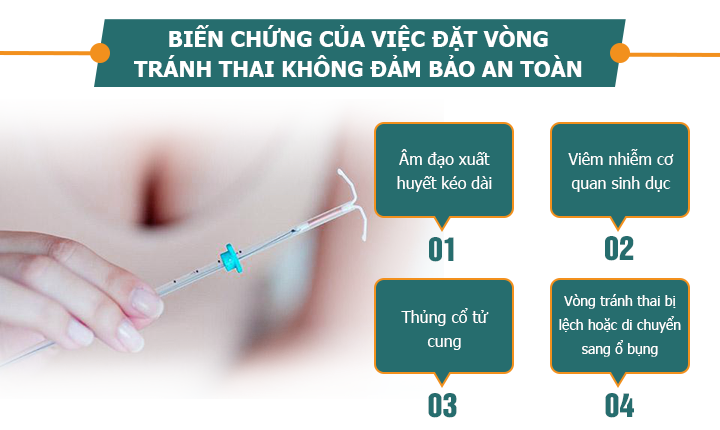 CÁC BIẾN CHỨNG KHÓ LƯỜNG KHI ĐẶT VÒNG TRÁNH THAI KHÔNG AN TOÀN