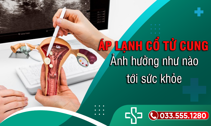 Áp lạnh cổ tử cung có ảnh hưởng gì không?