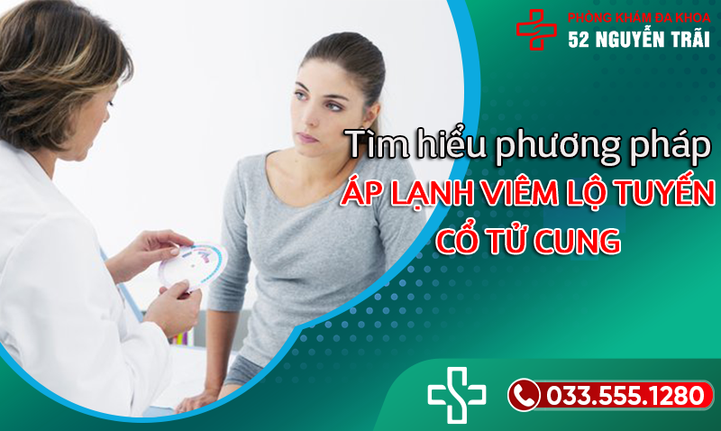 Áp lạnh viêm lộ tuyến cổ tử cung là như thế nào?