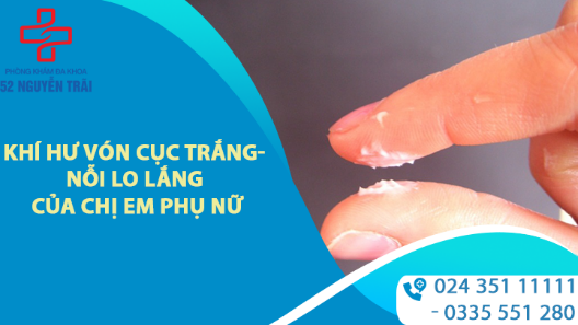 Khí hư vón cục trắng nguyên nhân do đâu? - Giải đáp từ bác sĩ chuyên khoa