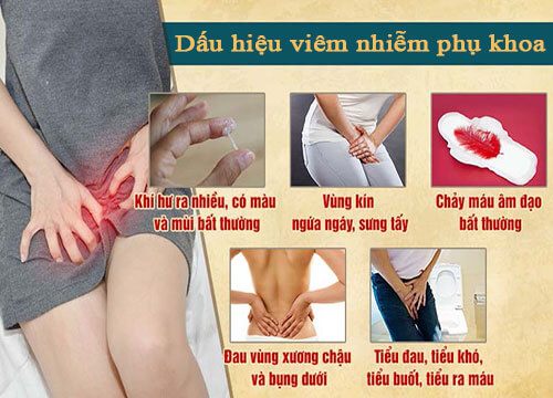 Dấu hiệu của viêm phụ khoa